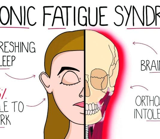 ‘I’ve Got A Confession. I Have ME’