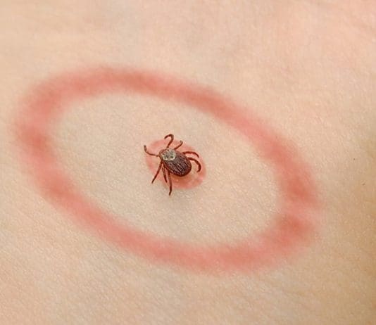 Watch out for ticks