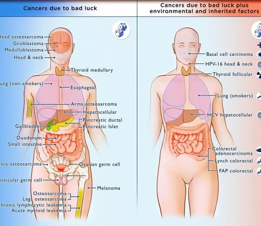 Has the NHS long-term plan missed out the less survivable cancers such a pancreatic cancer?