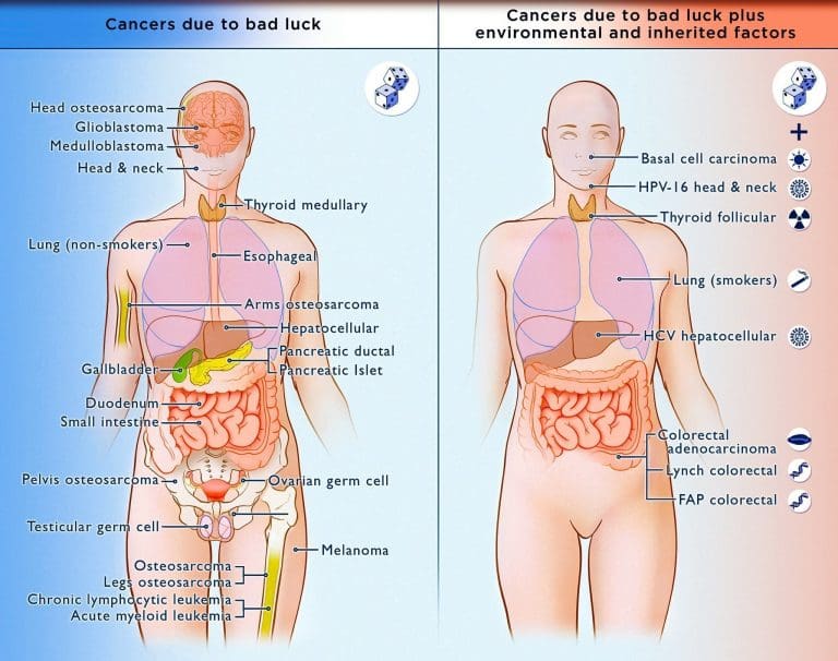 Has the NHS long-term plan missed out the less survivable cancers such a pancreatic cancer?