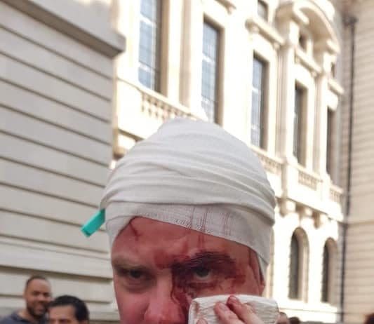 ‘This is what you get if you allow fascists to walk the streets’