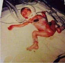 Local Maternity Services: The Betrayal