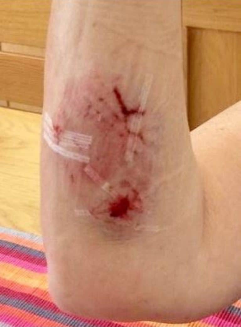 Appeal for information after woman bitten by dog in Poole