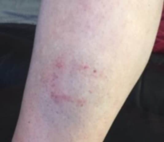 Appeal for information after woman in her 50’s bitten by dog in Poole