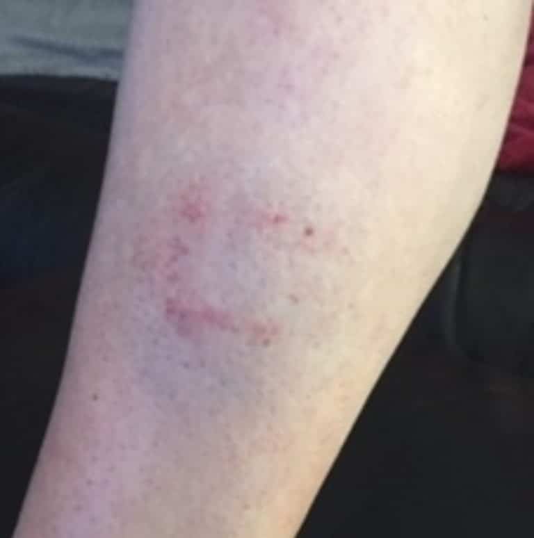 Appeal for information after woman in her 50’s bitten by dog in Poole