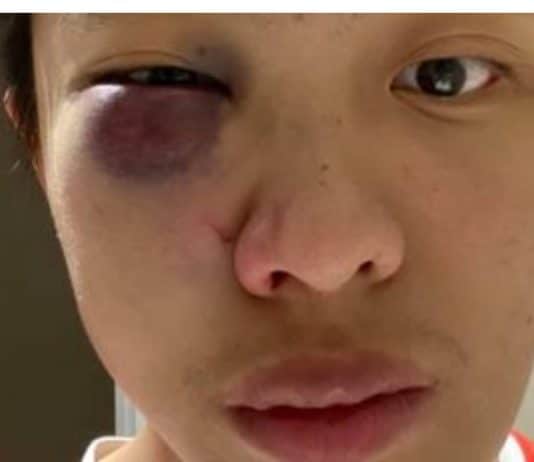 Racist hate crime against Chinese people surges across UK