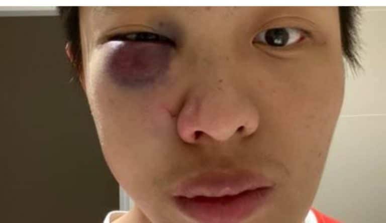 Racist hate crime against Chinese people surges across UK