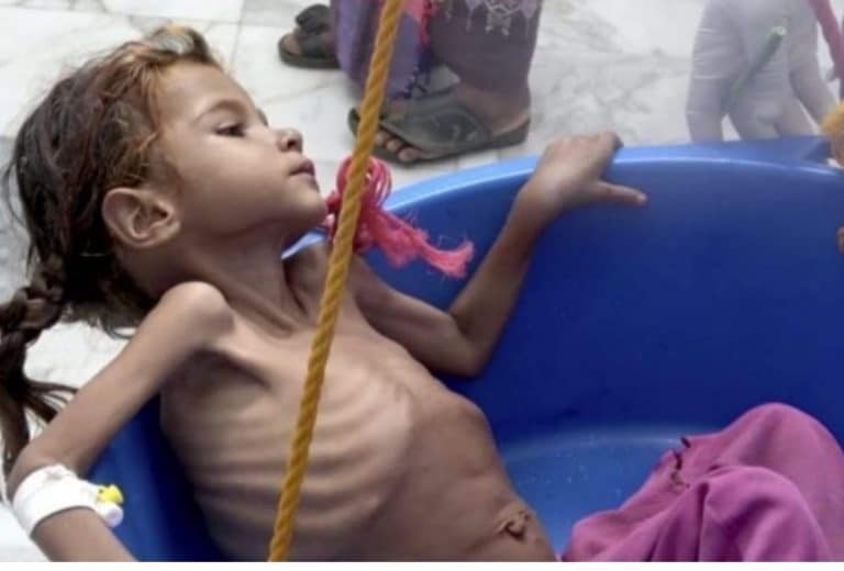 Millions of children will die in Yemen unless we stop looking the other way