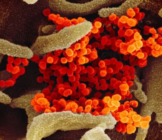 Are some theories surrounding the origins of Covid-19 being promoted and others supressed?