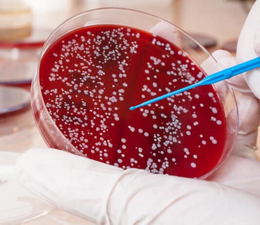 Over half the population cannot name a single symptom of third most lethal cancer