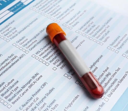 ‘Kamikaze Tory Brexit’ behind halt in some blood testing