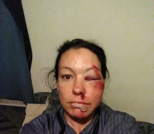 US public have to pay for ambulance use