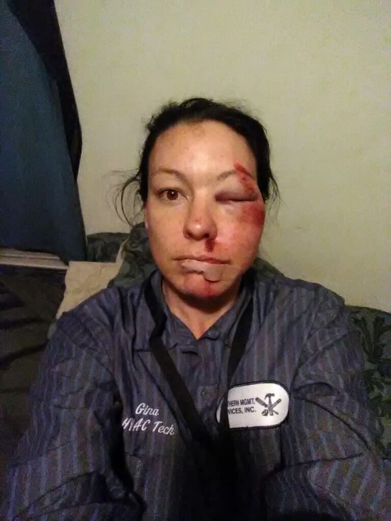 US public have to pay for ambulance use