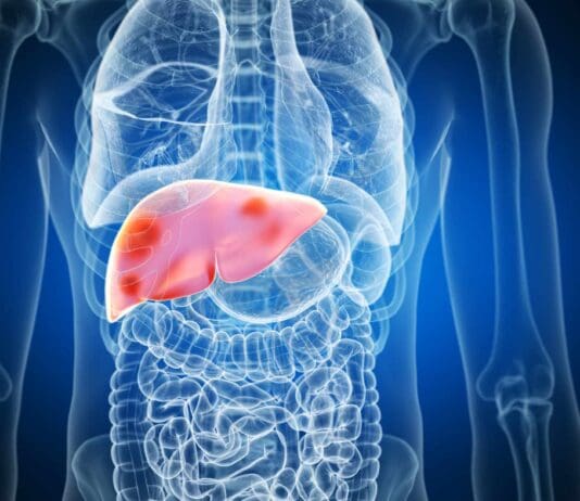 What foods are bad for the liver?