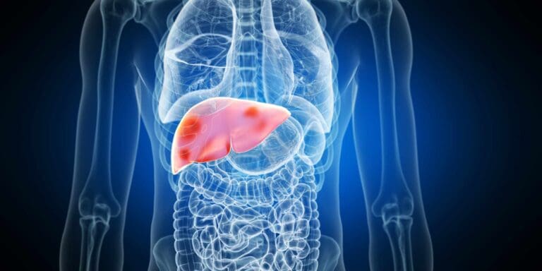 What foods are bad for the liver?