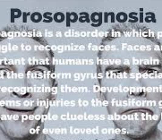 Increased exposure can help people with “face-blindness” put names to faces