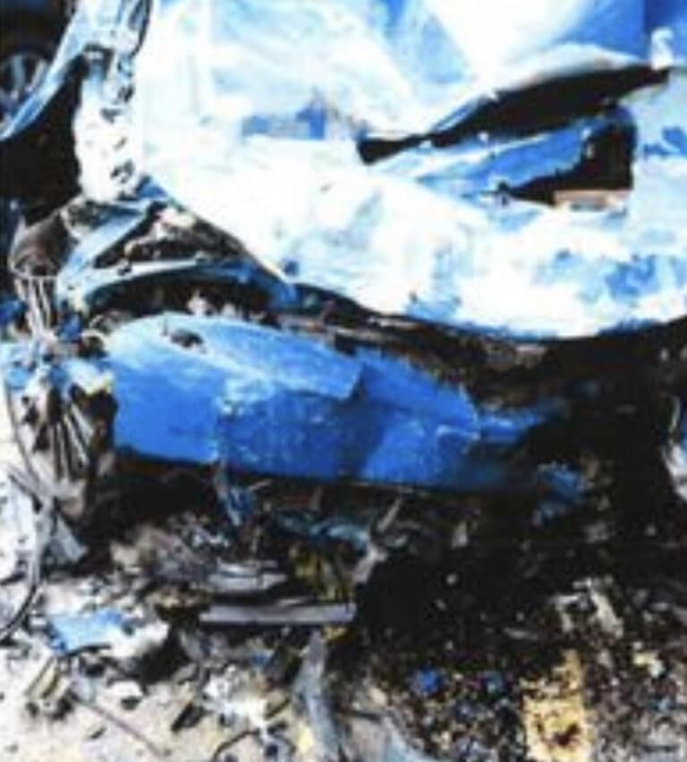 Nurse from Dorset ‘may never walk again’ following collision with uninsured driver