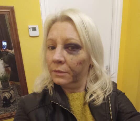 Woman warns public following robbery in Park District, Weymouth