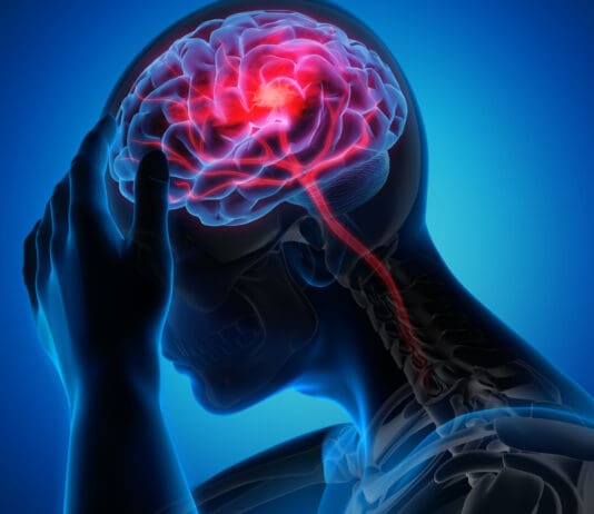 What to do if you suspect you or another is having a stroke