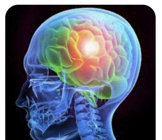 What are the Dangers of a Misdiagnosed Brain Injury?