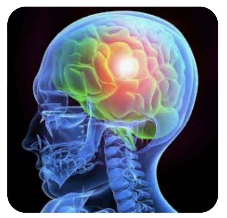 What are the Dangers of a Misdiagnosed Brain Injury?