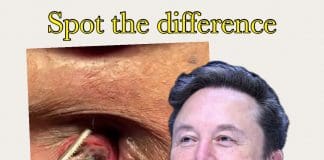 Elon Musk: The World’s Richest Haemorrhoid