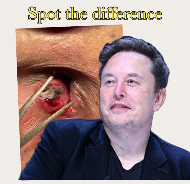 Elon Musk: The World’s Richest Haemorrhoid