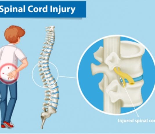 Spinal Cord Injury: A Truck Accident Injury with Life-Changing Effects