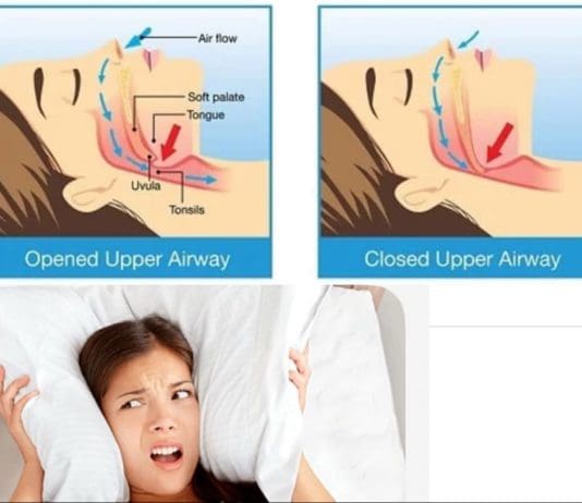 Ten Ways To Prevent Snoring