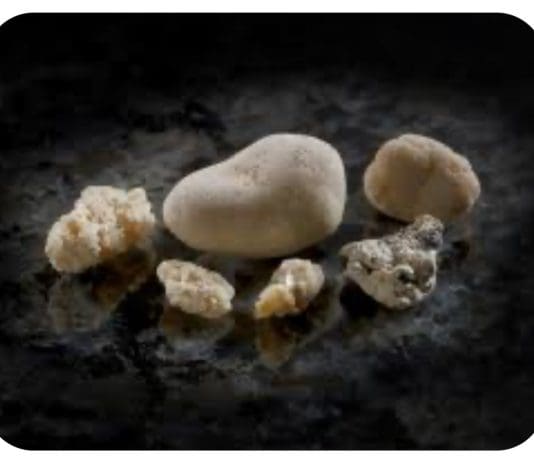 Pain-Free Living in England: Discover the Latest Kidney Stone Treatment Options Near You