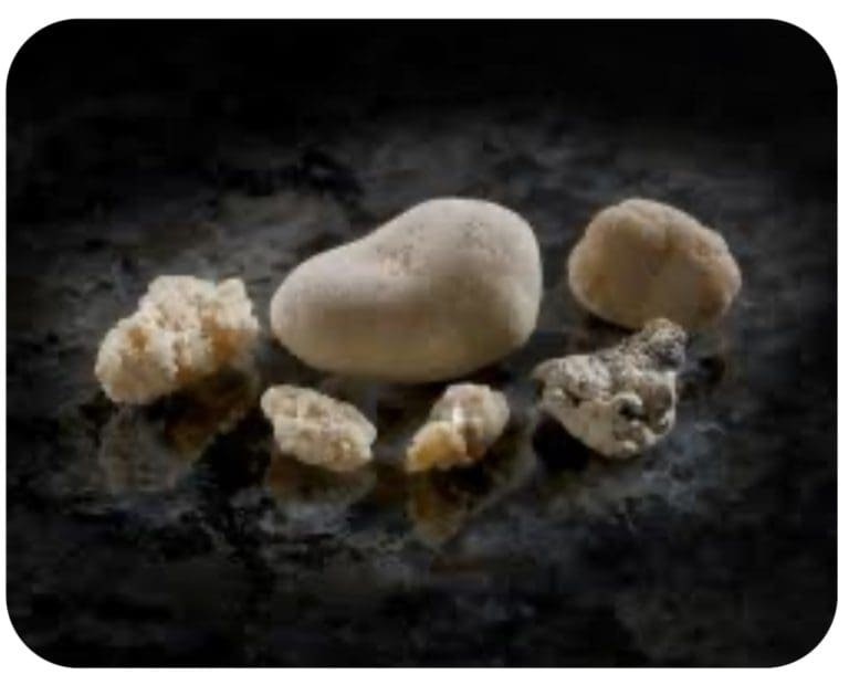 Pain-Free Living in England: Discover the Latest Kidney Stone Treatment Options Near You