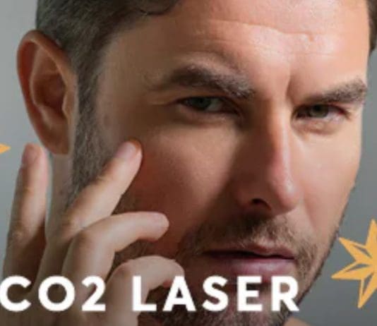 How CO2 Laser Resurfacing Can Transform Your Skin