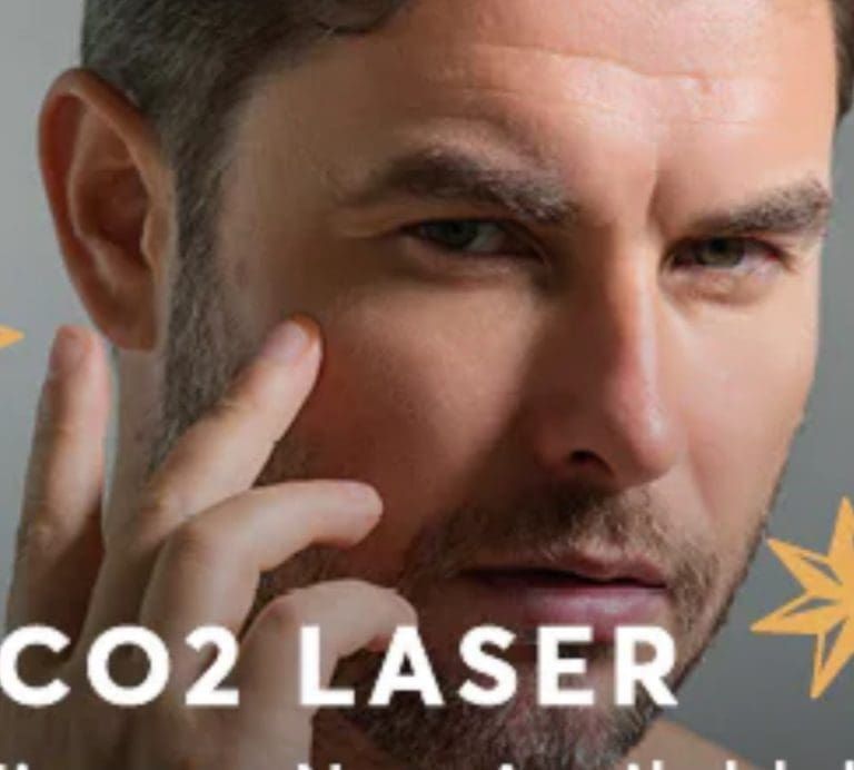 How CO2 Laser Resurfacing Can Transform Your Skin