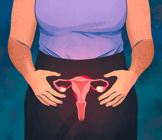 Breakthrough in Endometriosis Treatment: First Daily Tablet Approved for NHS Use