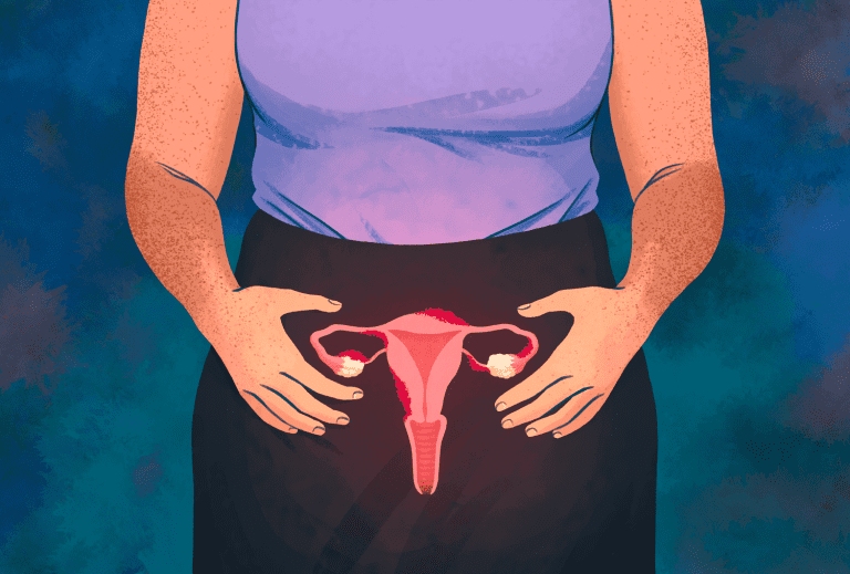 Breakthrough in Endometriosis Treatment: First Daily Tablet Approved for NHS Use