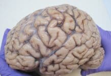 Things You Did Not Know About the Human Brain