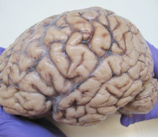 The Leave Campaign And Reform UK Have Exposed An Uncomfortable Truth