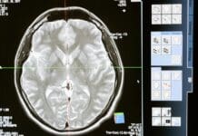 ‘Lack of Consultant Radiologists…’ Leads to Negligence Claims Against Dorset Hospitals