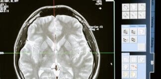 ‘Lack of Consultant Radiologists…’ Leads to Negligence Claims Against Dorset Hospitals